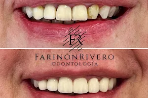 Implantes dentales Farinón Rivero image