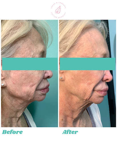 Find masonic tattoo ideas for your next unique tattoo in Temecula at Erase & Embrace Tattoo Removal