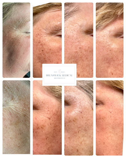 Explore band tattoo ideas, creative tattoo ideas in Brunswick, available at Brunswick Medical Aesthetics