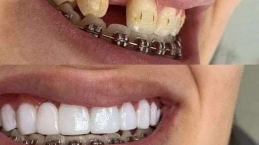 Laboratório de Prótese Dentária Top