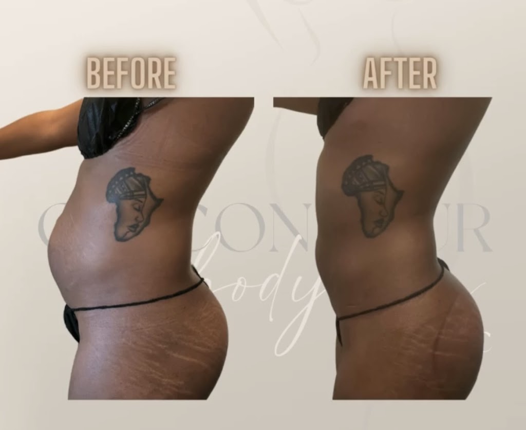 C. Contour Body Bar 94608