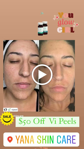 Laser Hair Removal Service «Yana Skin Care», reviews and photos, 3101 Richmond Ave #200, Houston, TX 77098, USA