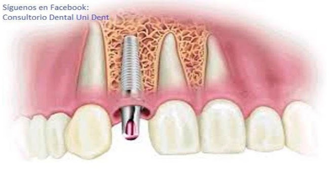 Consultorio Dental Uni - Dent
