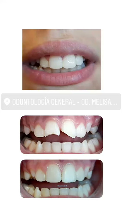 Odontología. OD. Melisa Pereyra