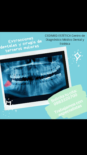 Clínica Dental CEDIMED-ESTETICA, Ortodoncia, Cuidado Dental, Trabajamos con Especialistas, Odontología y Cosmetología - Quito