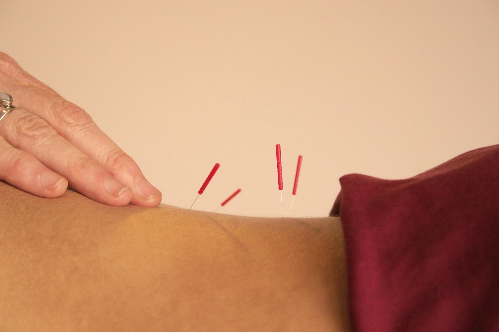 Berkeley Massage & Acupuncture 94709