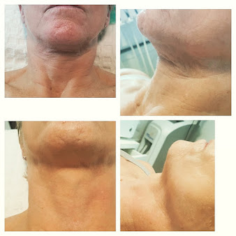 علوم الجلد1066 - Skin-Science1066