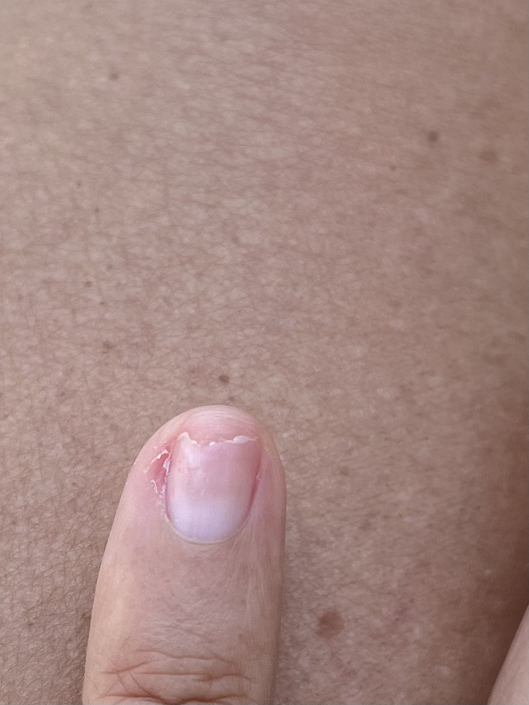 Photo n° 1 de l'avis de Devalliere.u fait le 06/07/2022 à 16:47