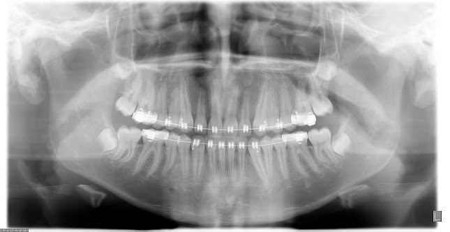 RAYDENT Radiografía Dental