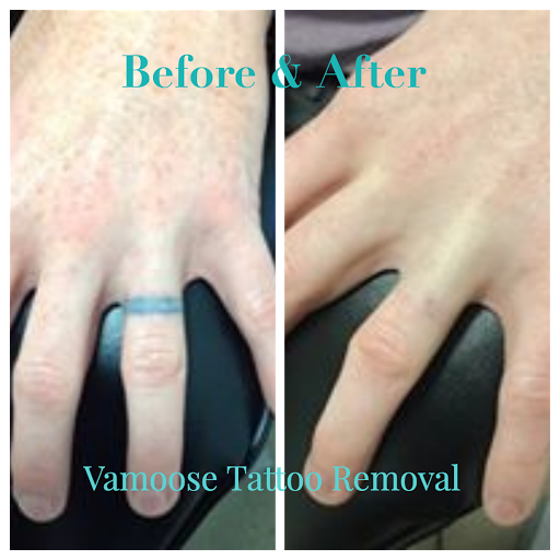 Explore 2x2 tattoo size ideas, creative tattoo ideas in Milwaukee, available at Removery Tattoo Removal & Fading