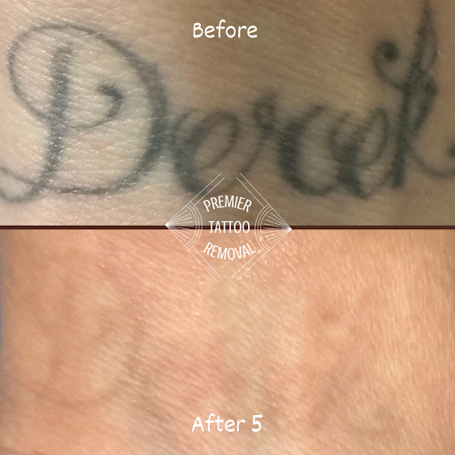 Explore cross tattoo ideas with meaning, creative tattoo ideas in Mckinney, available at Premier Tattoo Removal