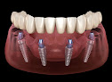 Parkview Dental & Dental Implant Centre