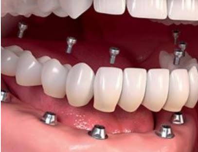 Clínica de Implantología Oral Del Valle