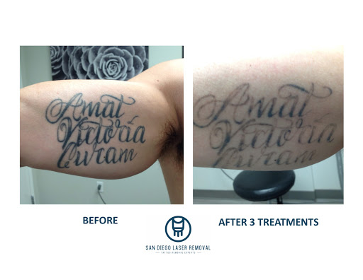 Find best men tattoo ideas for your next unique tattoo in San Diego at Removery Tattoo Removal & Fading