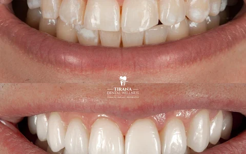 Klinike dentare-Tirana Dental Wellness image