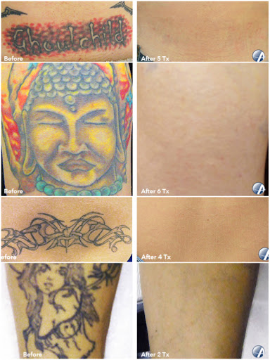 Explore easy tattoo ideas for females, creative tattoo ideas in San Diego, available at Evolve Tattoo Removal