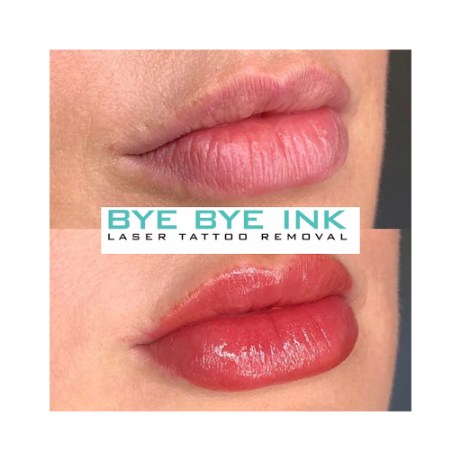 Explore small tattoo ideas behind ear, creative tattoo ideas in Middle Village, available at Bye Bye Ink Laser Tattoo Removal