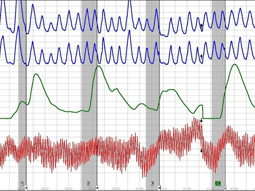 Polygraph service Mesquite