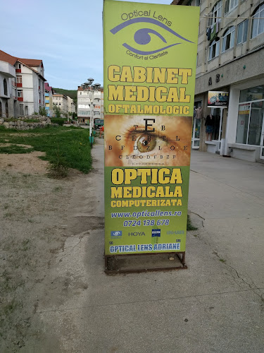 Optical Lens - Oftalmolog