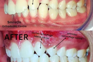 SmileOn Multi-Speciality Advanced Dental Clinic & Orthodontic Centre image