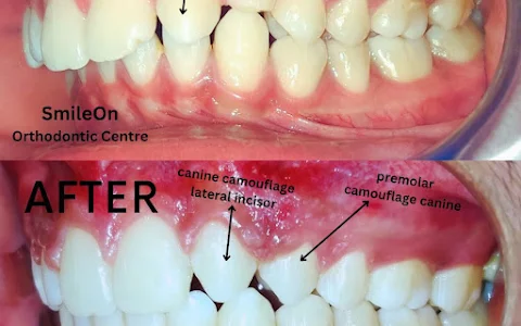 SmileOn Multi-Speciality Advanced Dental Clinic & Orthodontic Centre image