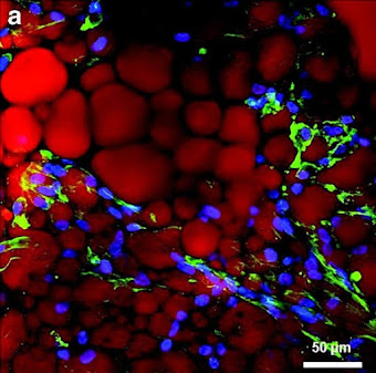 Cellular Treatments India - Cellular Treatments India