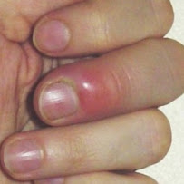 Wilbraham Nail Spa - Photo 2 - Car repair in Wilbraham, MA, Springfield