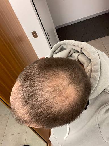 Medical Hair Transplant & Aesthetics image