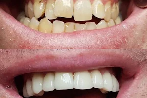 Hungary Dental Implant image