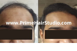 Prime Clinics - Prime Hair Studio & Cosmetic Clinic image