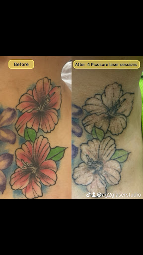 Explore sunflower tattoo idea, creative tattoo ideas in New York, available at Ag2g Laser Tattoo Removal & MedSpa