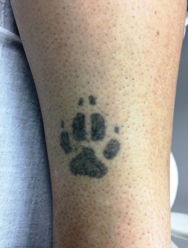 Explore arm tattoo ideas womens, creative tattoo ideas in Springfield, available at Under My Skin Tattoo Removal