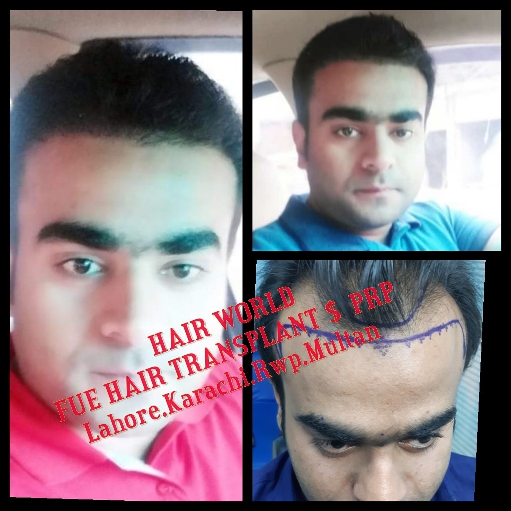 Hair World Pakistan
