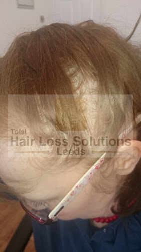Reviews of Total Hair Loss Solutions in Leeds - Beauty salon