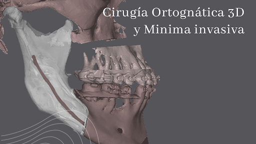 Dra. Irlanda Diaz Cardona, Cirujano maxilofacial