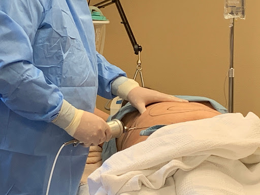 Explore cool tattoo filler ideas, creative tattoo ideas in Spokane, available at Premier Body and Laser