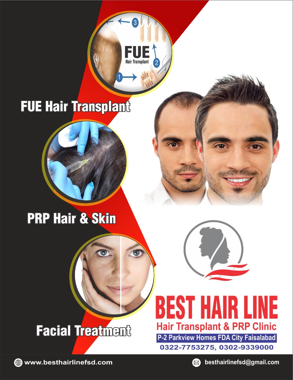 Best Hair Line Faisalabad Hair Transplant & PRP Clinic