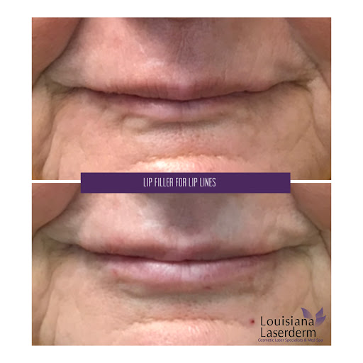 Explore jr tattoo ideas, creative tattoo ideas in Baton Rouge, available at Louisiana Laserderm