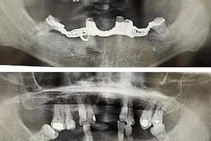 Monterey Dental Implant Center image