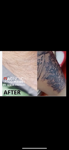 Explore ny yankees tattoo ideas, creative tattoo ideas in Victorville, available at Goawaytats tattoo removal