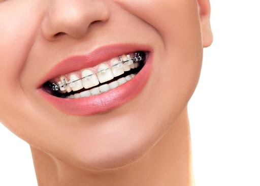 Smile Spot - Clinica de Ortodontie