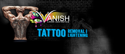Explore cover up tattoo ideas for chest, creative tattoo ideas in Longview, available at Vanish Laser Aesthetics