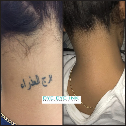 Explore dave matthews tattoo ideas, creative tattoo ideas in Middle Village, available at Bye Bye Ink Laser Tattoo Removal