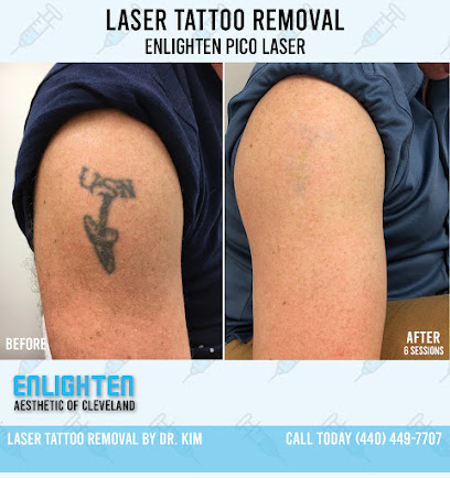 Enlighten Aesthetic of Cleveland: Laser Tattoo Removal, Fillers, Botox & PRP