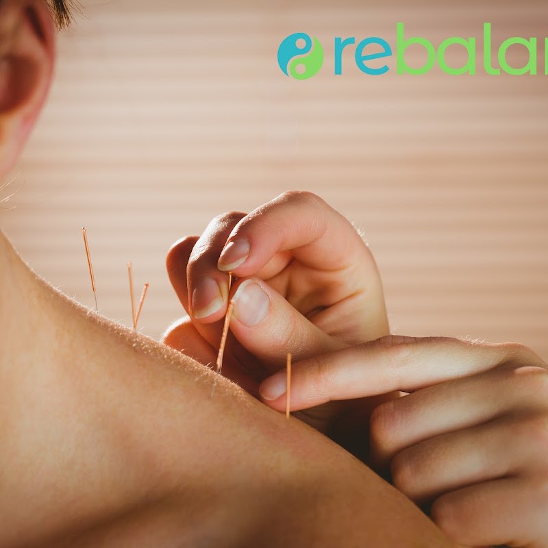 Rebalance Acupuncture Edmonton