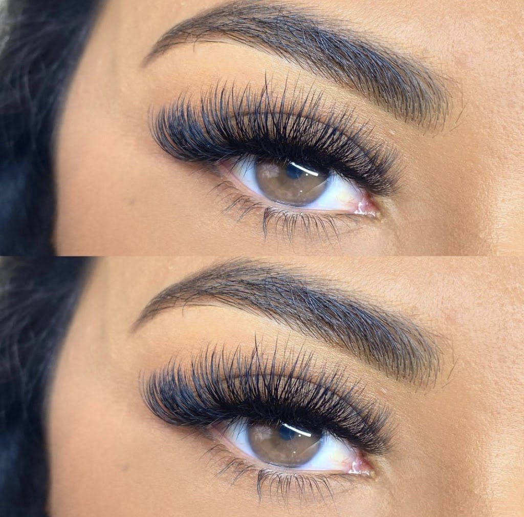 KVM AESTHETICS 93001