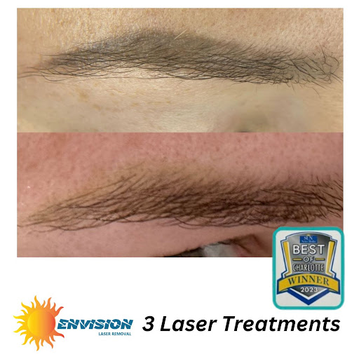 Explore white tiger tattoo ideas, creative tattoo ideas in Port Charlotte, available at Envision Laser Removal