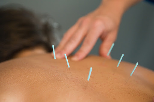 Mari Greenly LAc Acupuncture
