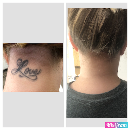 Explore anime tattoo ideas for guys, creative tattoo ideas in Longview, available at Vanish Laser Aesthetics