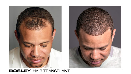 Hair Transplantation Clinic «Bosley Medical - Raleigh», reviews and photos, 4700 Falls of Neuse Rd #205, Raleigh, NC 27609, USA